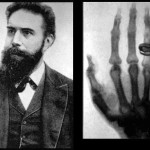 Rontgen, Hounsfield and the History of Radiology